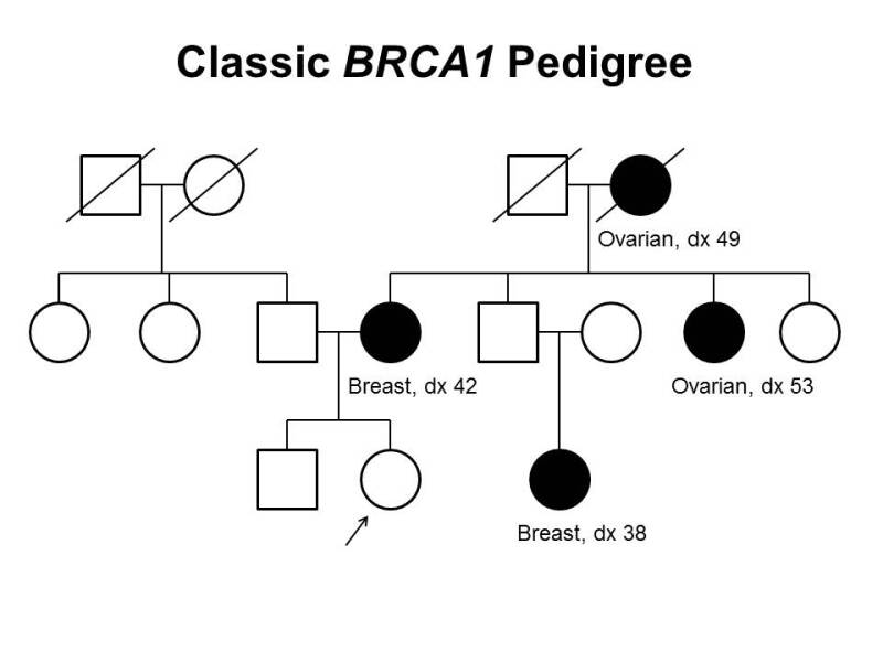 BRCA1 pedigree example